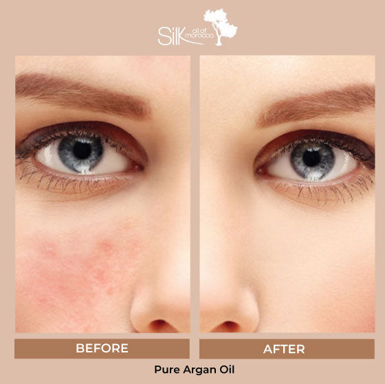 Pure Argan Oil
