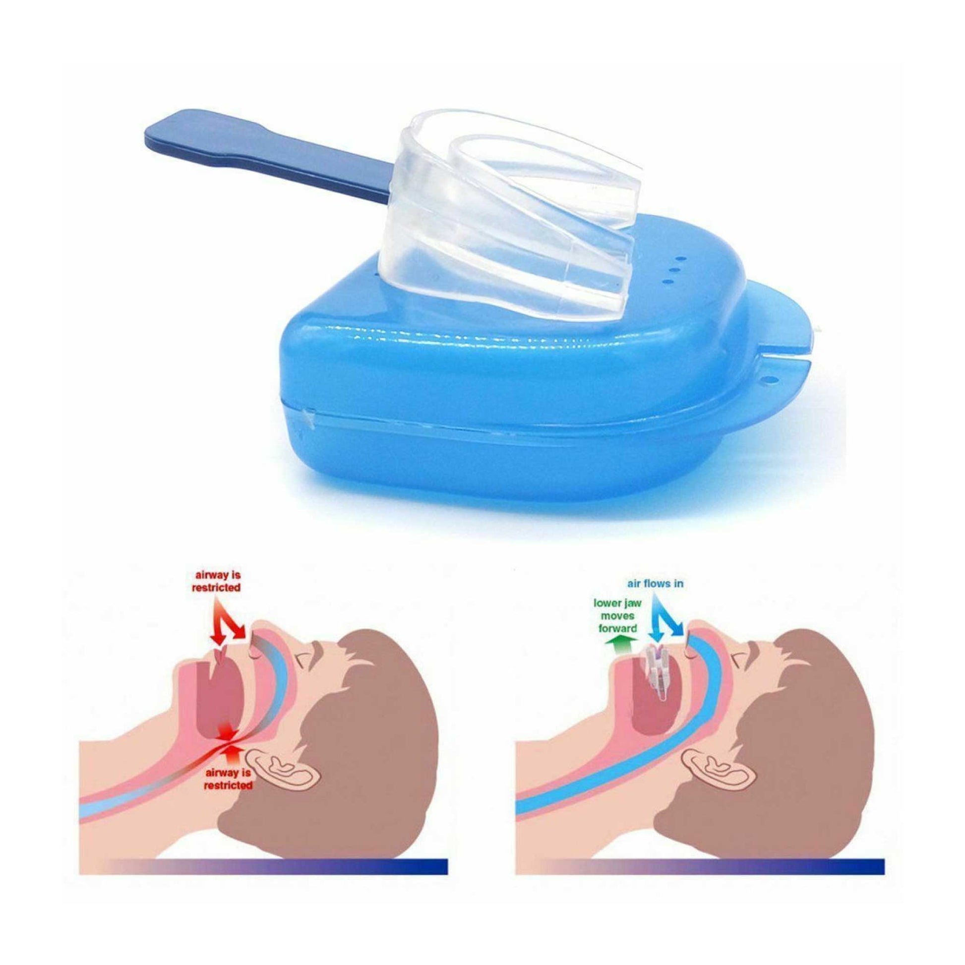 Social Hike 2x Mouthguard + Nose Clip Anti Snoring Sleep Aid Devices