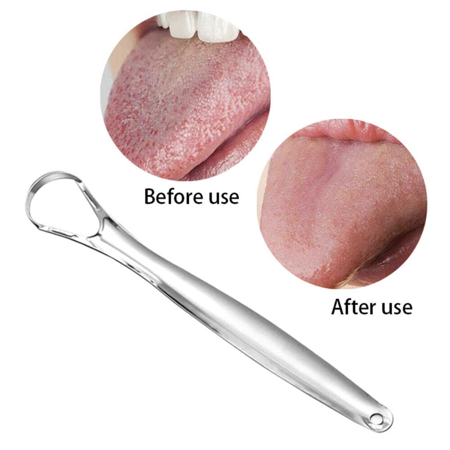 Stainless Steel Tongue Scraper Cleaner Oral Hygiene Reduce Bad Breath Metal Tool